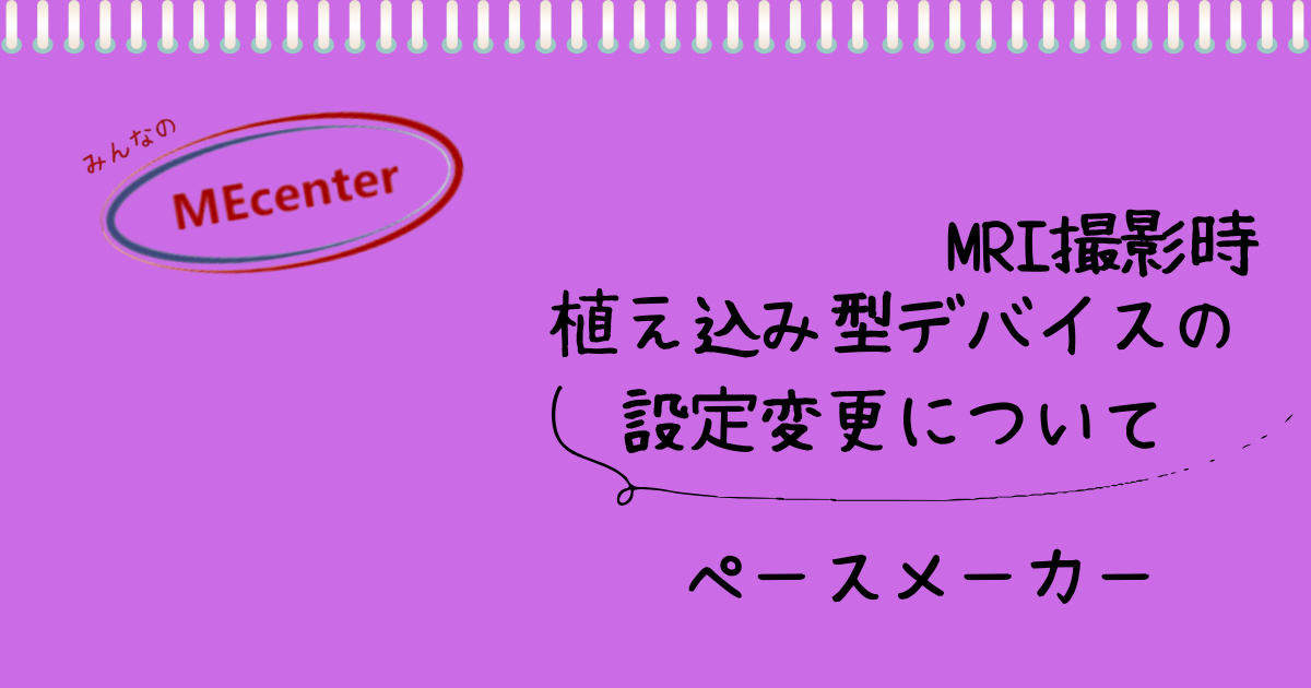 植え込み型デバイスの設定変更について