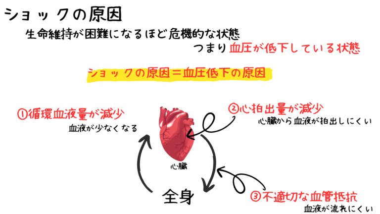 臨床工学技士がショック対応で迷う理由と初動判断 | みんなのMEセンター
