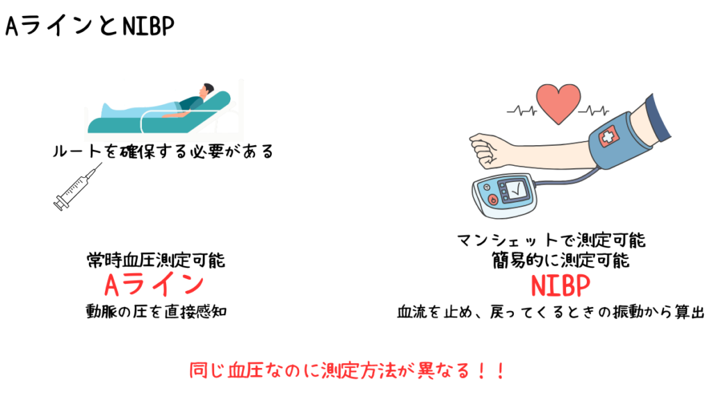 絶対に知っておきたい ICUでのAラインについて | みんなのMEセンター