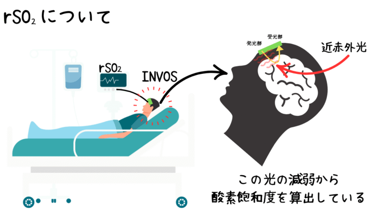 rSO₂をマスターしよう！脳酸素モニタリングの知識と実践 | みんなのMEセンター
